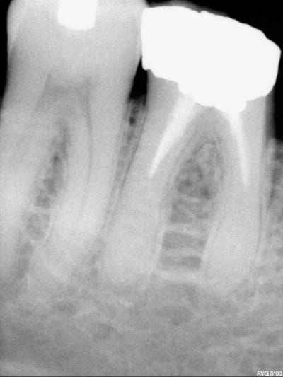 Radios6 ycayfo - Eugenol