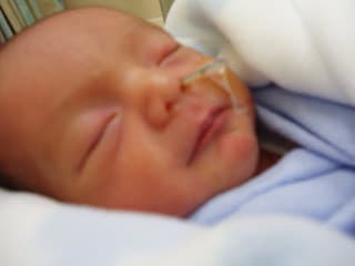 No more nose tube!