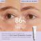 CAUDALIE - Vinoperfect Brightening Eye Cream Κρέμα Ματιών κατά των Μαύρων Κύκλων - 15ml
