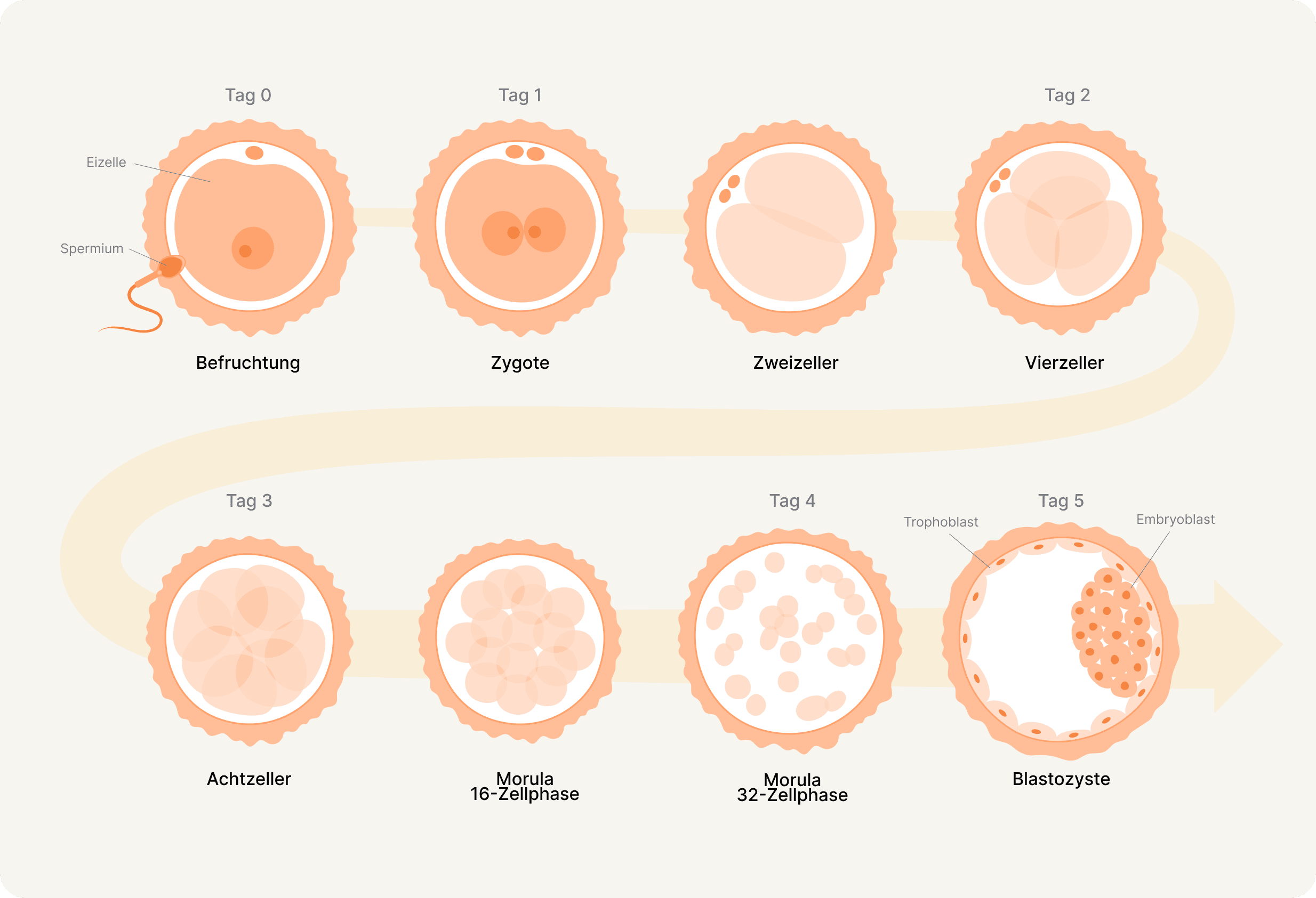 Entwicklung Embryo IVF ICSI Blastozyste Transfer an Tag 2 Tag 5