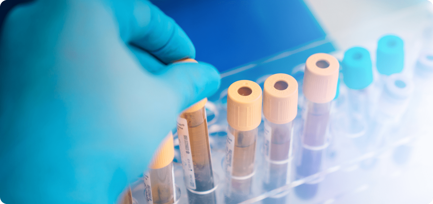 Genetic Testing for Infertility: What You Need to Know