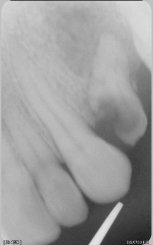 001 xvgnzs - Eugenol