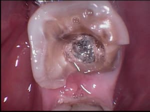 006 fhcecr - Eugenol