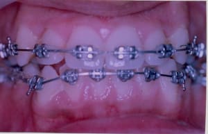 01 03 07  f tsops4 - Eugenol