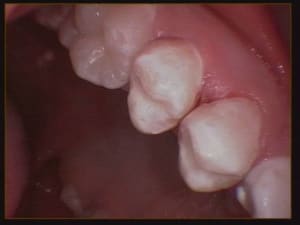 010 cijgf4 - Eugenol
