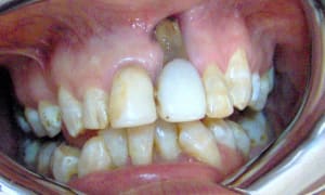 031 lnmc06 - Eugenol