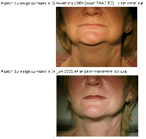 050614 dp bsnn3p - Eugenol