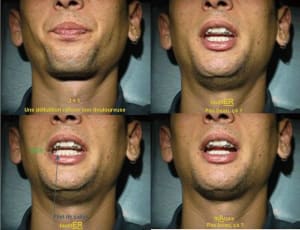 051018 tr02 gfmdhk - Eugenol