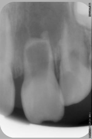 051 iw5zlu - Eugenol