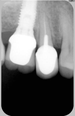 071 jpeg hwfpf5 - Eugenol