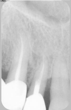 08 di1sur - Eugenol