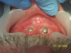 100 1209 qyenap - Eugenol