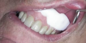 100 3465 k37mwa - Eugenol