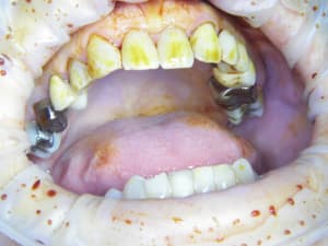 100 7674 wpurgd - Eugenol