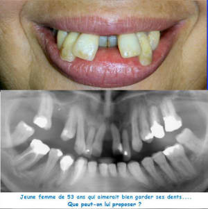 10343 a lvguju - Eugenol