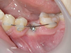 10882 5bis la0pkm - Eugenol