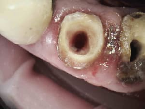 10 mmdapa - Eugenol