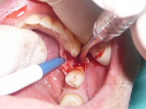 10 qvu4yb - Eugenol