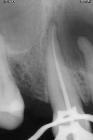 13 per op h47buw - Eugenol