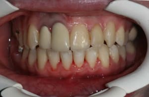 13 n98g1y - Eugenol