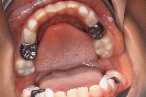 14 avril2010 002  small  lpj7sf - Eugenol