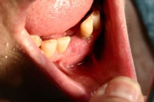 16 depose des pts a 15j ap pzzuwv - Eugenol