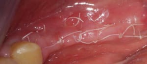 1601100 10152158525438909 1616646947 n t92f59 - Eugenol