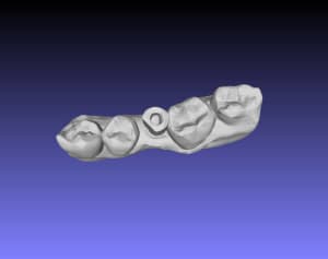 17031306 cas implantaire rizzo   mandibule scan body stl ajv93c - Eugenol