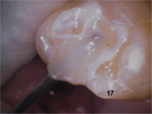 17 09 yslekf - Eugenol