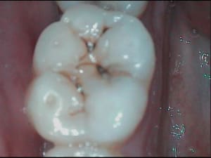 1 h75zgy - Eugenol