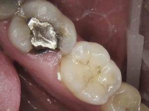 1 ybbqbg - Eugenol