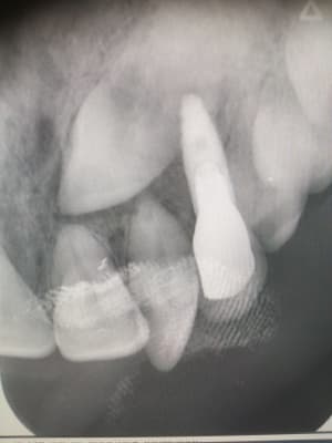 1cehfyo452d8vb4e4rhx349l17tv - Eugenol