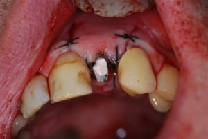 2007 01 06 028 kiaed3 - Eugenol