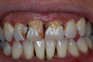 2007 02 13 055 igtghu - Eugenol