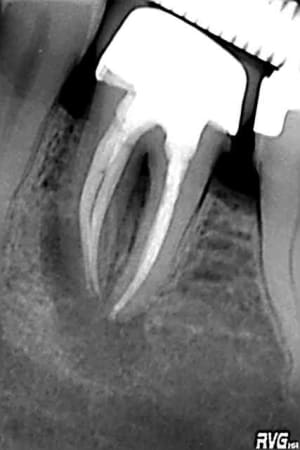 20070515mateu cxl73t - Eugenol