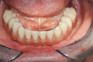 2008 11 14 017 q34xeg - Eugenol