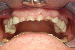 2009 01 16 014 jxho95 - Eugenol