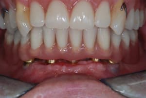 2009 07 12 002 enqn7n - Eugenol