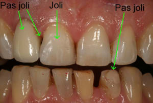 2011 10 29 093523 juopqm - Eugenol