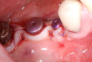 2012 04 06 002 oy9iqz - Eugenol