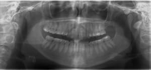 20120208 w9ibur - Eugenol