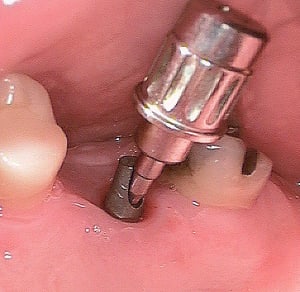 20120327 152445 ctz2az - Eugenol