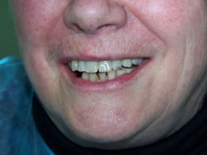 2013 03 12 positdental 075 q6v8jd - Eugenol