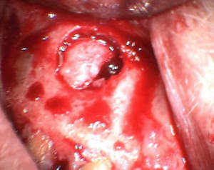 2 pafbfi - Eugenol