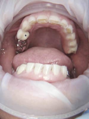 2 feygra - Eugenol