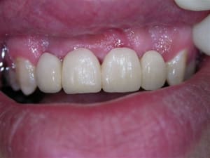 2 tm3qaz - Eugenol