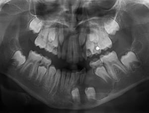 33 34 10 10 2007 2  qabjjt - Eugenol