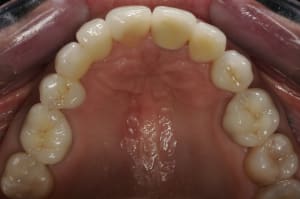 3468525e be99 421b aae2 1f55c1e7c2ec wf7ifo - Eugenol