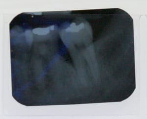 37 avant sgtutm - Eugenol