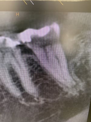 38d7b82b c556 4933 a0d0 39c9f81bf938 pa3xhw - Eugenol